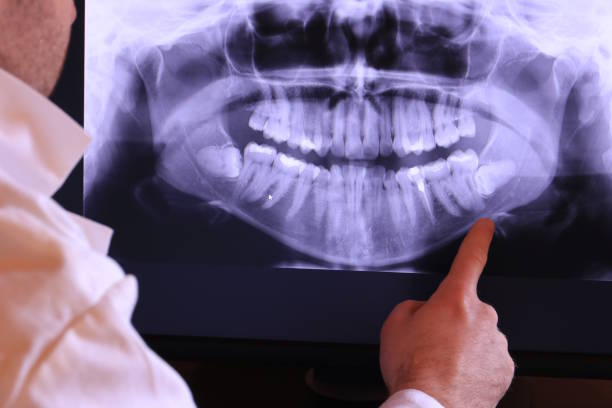 Best Emergency Tooth Extraction in Urbancrest, OH