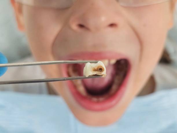 Professional Emergency Dentist in OH
